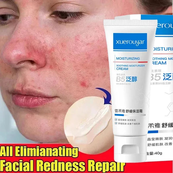 B5 Redness Relief & Skin Repair Cream