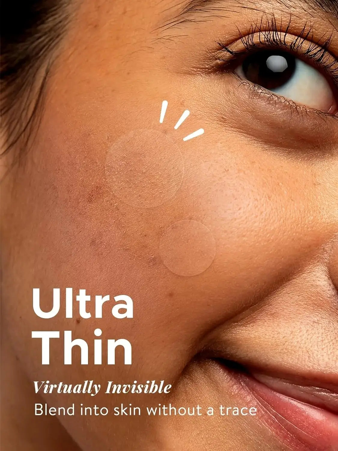 Invisible Acne Patches – 360pcs Healing Set